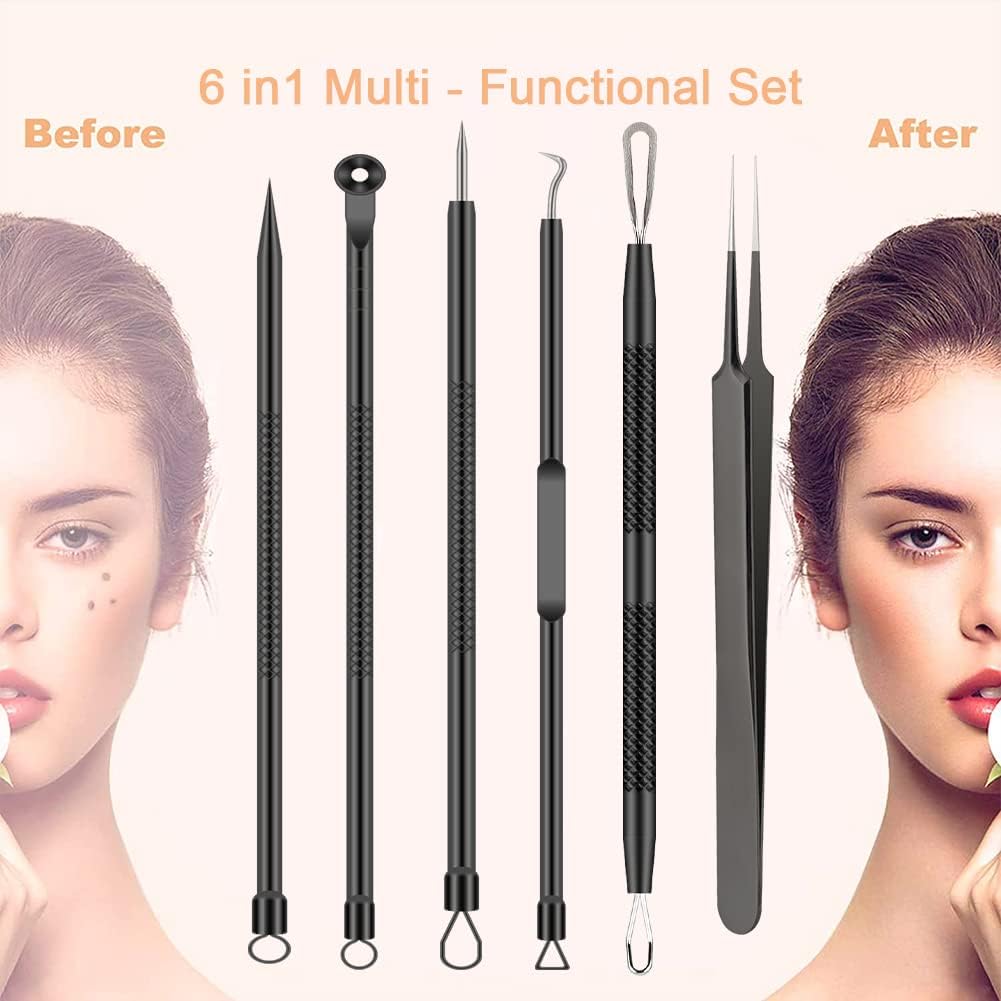 6Pcs Pimple Popper Tool Kit - Blackhead Remover Acne Needle Tools Set Health & Beauty Skin Care https://fairsmartshop.com/6pcs-pimple-popper-tool-kit-blackhead-remover-acne-needle-tools-set/