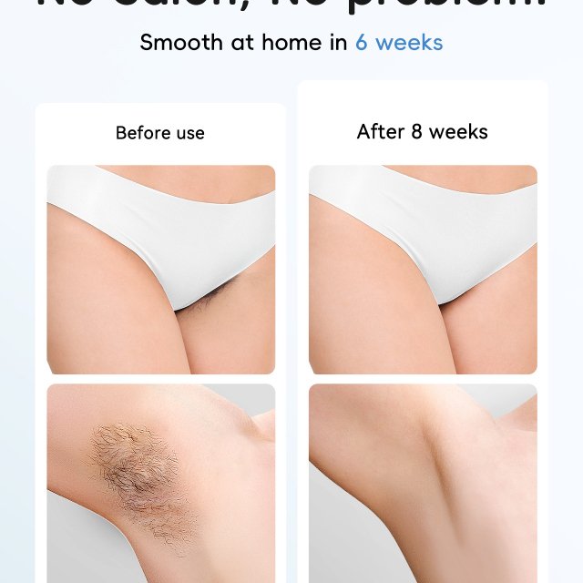 Painless Whole Body Epilator for Home Use - Image 6