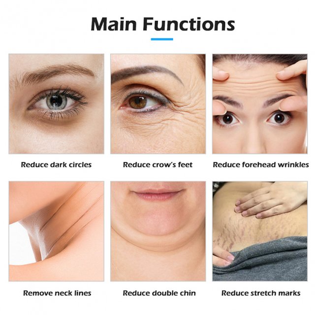 448KHz RF Skin Tightening & Anti-Wrinkle Device - Image 5